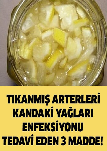 Tıkanmış Arterleri ve Kandaki Yağları Destekleyici 3 Doğal Bileşen